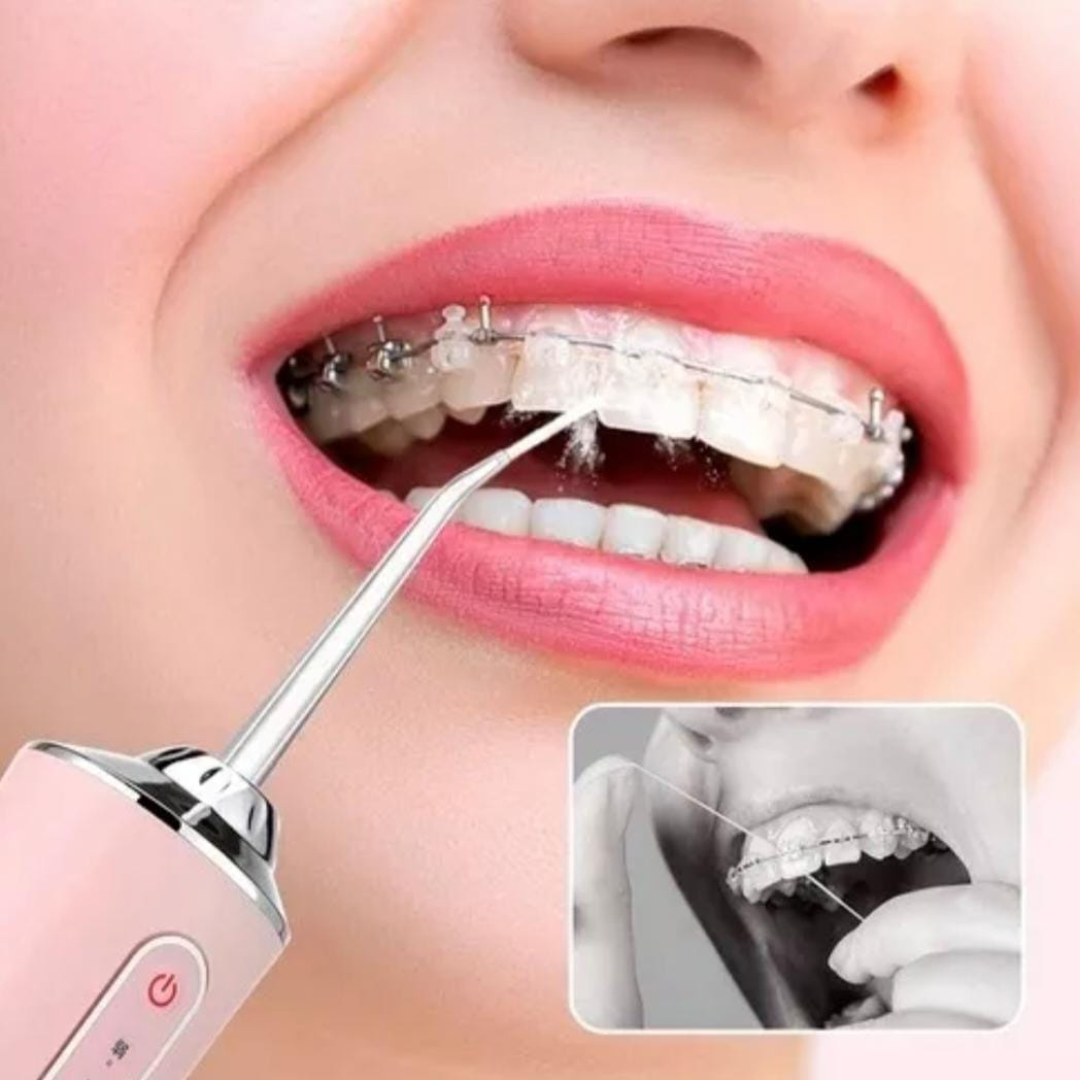 IRRIGADOR DENTAL PORTÁTIL